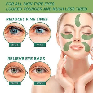 Relaxi™ - Uitstekende zorg voor uw ogen - Trifoglio